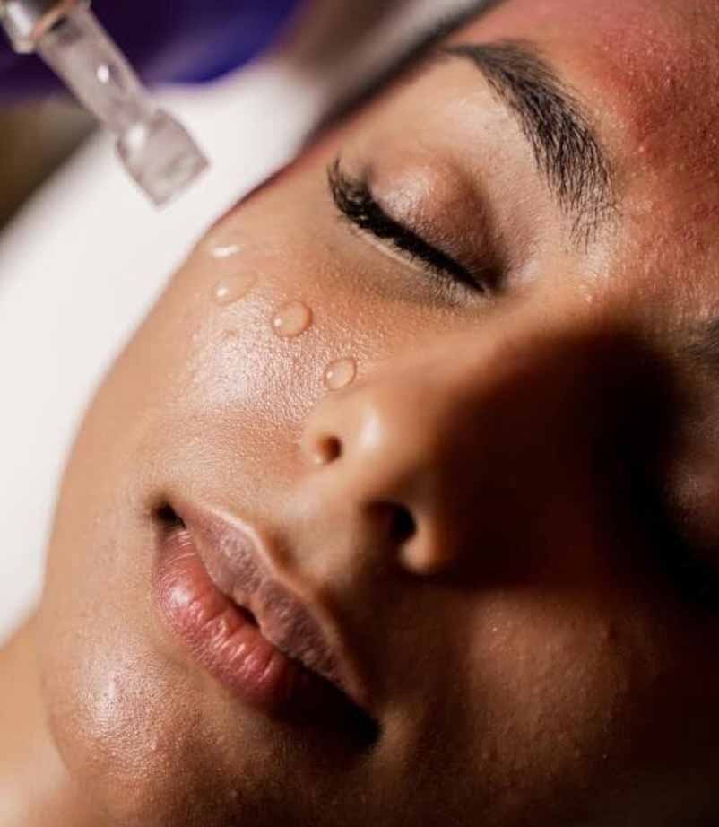 skin-microneedling